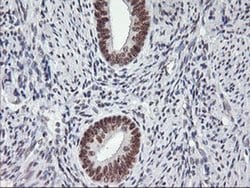USP7 Monoclonal Antibody (OTI3C1), TrueMAB , OriGene 100 &mu;L; Unconjugated:Antibodies,