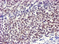 USP7 Monoclonal Antibody (OTI3C7), TrueMAB , OriGene 100 &mu;L; Unconjugated:Antibodies,