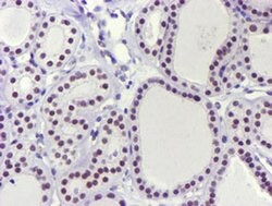 USP7 Monoclonal Antibody (OTI3C7), TrueMAB , OriGene 100 &mu;L; Unconjugated:Antibodies,