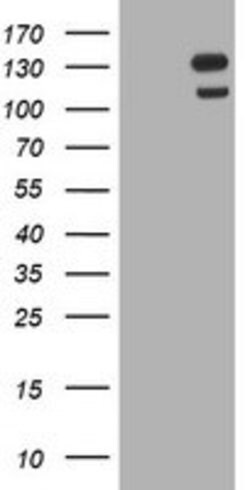 USP7 Mouse anti-Human, Clone: OTI1F12, lyophilized, TrueMAB 100 &mu;g;