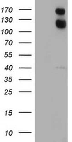 USP7 Monoclonal Antibody (OTI3D3), TrueMAB , OriGene 30 &mu;L; Unconjugated:Antibodies,