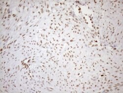 UTP11L Mouse anti-Human, Clone: OTI5F3, lyophilized, TrueMAB 100 &mu;g;