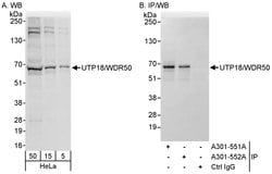 UTP18/WDR50 Rabbit anti-Human, Polyclonal, Bethyl Laboratories 100 &mu;L;