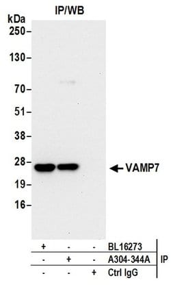 VAMP7 Rabbit anti-Human, Mouse, Polyclonal, Bethyl Laboratories 100 &mu;L | Buy Online | Bethyl Laboratories, Inc | Fisher Scientific