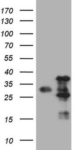 VAPA Monoclonal Antibody (OTI1D3), TrueMAB , OriGene 100 &mu;L; Unconjugated:Antibodies,