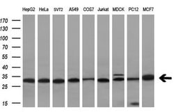 VAPA Monoclonal Antibody (OTI1D3), TrueMAB , OriGene 100 &mu;L; Unconjugated:Antibodies,