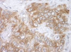 VAPB Rabbit anti-Human, Mouse, Polyclonal, Bethyl Laboratories 100 &mu;L;