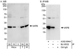 VAPB Rabbit anti-Human, Mouse, Polyclonal, Bethyl Laboratories 100 &mu;L;