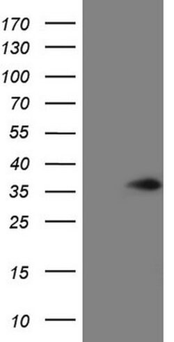 VAPB Mouse anti-Human, Clone: OTI4C8, lyophilized, TrueMAB 100 &mu;g; Unconjugated:Antibodies,