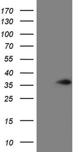 VAPB Monoclonal Antibody (OTI4C8), TrueMAB , OriGene:Antibodies:Primary