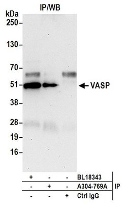 VASP Rabbit anti-Human, Mouse, Polyclonal, Bethyl Laboratories 100 &mu;L;