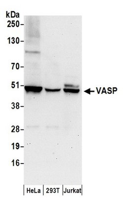 VASP Rabbit anti-Human, Mouse, Polyclonal, Bethyl Laboratories 100 &mu;L;