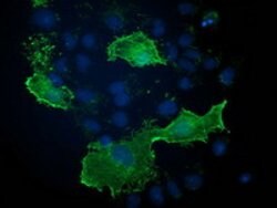 VASP Mouse anti-Human, Clone: OTI1C3, lyophilized, TrueMAB 100 &mu;g; Unconjugated:Antibodies,