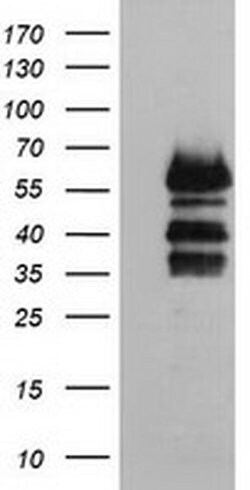 VASP Monoclonal Antibody (OTI1H8), TrueMAB , OriGene 100 &mu;L; Unconjugated:Antibodies,