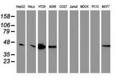 VASP Monoclonal Antibody (OTI1H8), TrueMAB , OriGene 100 &mu;L; Unconjugated:Antibodies,