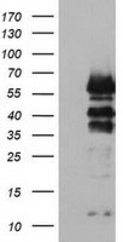 VASP Mouse anti-Human, Clone: OTI1C3, lyophilized, TrueMAB 100 &mu;g; Unconjugated:Antibodies,
