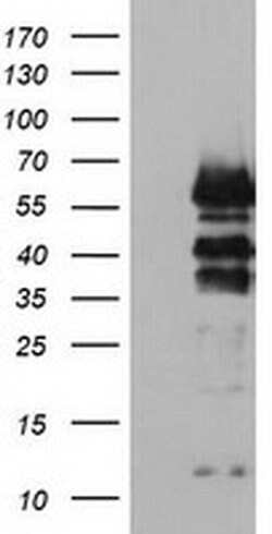 VASP Monoclonal Antibody (OTI1C3), TrueMAB , OriGene 30 &mu;L; Unconjugated:Antibodies,