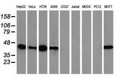 VASP Mouse anti-Human, Clone: OTI1C3, lyophilized, TrueMAB 100 &mu;g; Unconjugated:Antibodies,