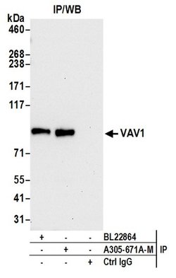 VAV1 Polyclonal Antibody, Bethyl Laboratories 20 &mu;L; Unconjugated:Antibodies,