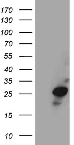 VAX1 Mouse anti-Human, Clone: OTI1E7, lyophilized, TrueMAB 100 &mu;g; Unconjugated:Antibodies,