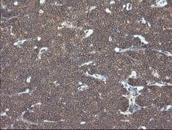 VBP1 Monoclonal Antibody (OTI1D1), TrueMAB , OriGene 100 &mu;L; Unconjugated:Antibodies,
