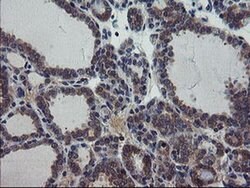 VBP1 Monoclonal Antibody (OTI1A5), TrueMAB , OriGene 100 &mu;L; Unconjugated:Antibodies,