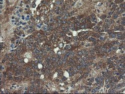 VBP1 Monoclonal Antibody (OTI2C2), TrueMAB , OriGene 100 &mu;L; Unconjugated:Antibodies,