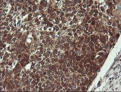 VBP1 Monoclonal Antibody (OTI2C2), TrueMAB , OriGene 100 &mu;L; Unconjugated:Antibodies,