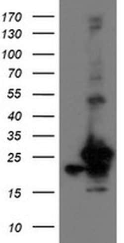 VBP1 Monoclonal Antibody (OTI2C2), TrueMAB , OriGene 100 &mu;L; Unconjugated:Antibodies,