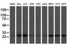 VBP1 Monoclonal Antibody (OTI2C2), TrueMAB , OriGene 100 &mu;L; Unconjugated:Antibodies,