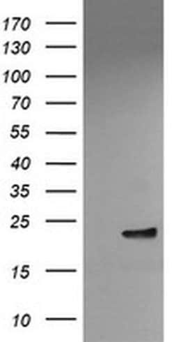 VBP1 Monoclonal Antibody (OTI2G2), TrueMAB , OriGene 30 &mu;L; Unconjugated:Antibodies,