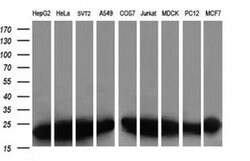 VBP1 Monoclonal Antibody (OTI2G2), TrueMAB , OriGene 30 &mu;L; Unconjugated:Antibodies,