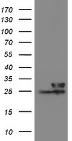 VBP1 Monoclonal Antibody (OTI1G3), TrueMAB , OriGene 30 &mu;L; Unconjugated:Antibodies,