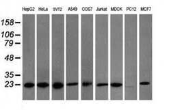VBP1 Monoclonal Antibody (OTI1G3), TrueMAB , OriGene 30 &mu;L; Unconjugated:Antibodies,