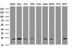 VBP1 Mouse anti-Human, Clone: OTI1H5, lyophilized, TrueMAB 100 &mu;g; Unconjugated:Antibodies,