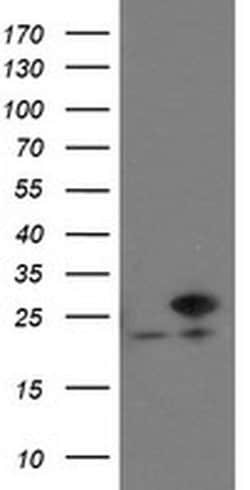VBP1 Monoclonal Antibody (OTI2F2), TrueMAB , OriGene 30 &mu;L; Unconjugated:Antibodies,