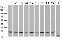 VBP1 Mouse anti-Human, Clone: UMAB75, liquid, UltraMAB 30 &mu;L; Unconjugated:Antibodies,