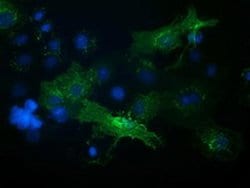 VCAM1 Monoclonal Antibody (OTI2G5), TrueMAB , OriGene 100 &mu;L; Unconjugated:Antibodies,