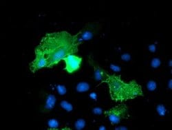 VCAM1 Monoclonal Antibody (OTI3G7), TrueMAB , OriGene 100 &mu;L; Unconjugated:Antibodies,