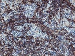 VCAM1 Monoclonal Antibody (OTI3G7), TrueMAB , OriGene 100 &mu;L; Unconjugated:Antibodies,