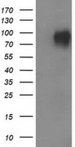 VCAM1 Monoclonal Antibody (OTI2G5), TrueMAB , OriGene 100 &mu;L; Unconjugated:Antibodies,