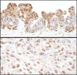 VCP Rabbit anti-Human, Mouse, Polyclonal, Bethyl Laboratories 100 &mu;l;