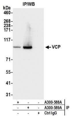 VCP Rabbit anti-Human, Mouse, Polyclonal, Bethyl Laboratories 100 &mu;L;