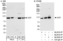 VCP Rabbit anti-Human, Mouse, Polyclonal, Bethyl Laboratories 100 &mu;l;
