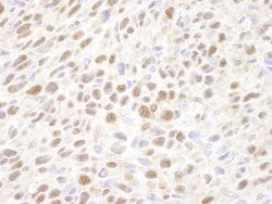 VCP Polyclonal Antibody, Bethyl Laboratories 10 &mu;L | Buy Online | Bethyl Laboratories, Inc | Fisher Scientific