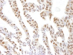 VCP Polyclonal Antibody, Bethyl Laboratories 10 &mu;L | Buy Online | Bethyl Laboratories, Inc | Fisher Scientific