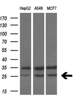 VEGF Mouse anti-Human, Clone: OTI4E3, lyophilized, TrueMAB 100 &mu;g; Unconjugated:Antibodies,