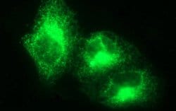 VEGFB Monoclonal Antibody (OTI2D6), TrueMAB , OriGene:Antibodies:Primary
