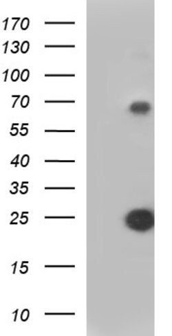 VEGFB Mouse anti-Human, Clone: OTI2C4, lyophilized, TrueMAB 100 &mu;g;