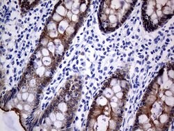 VIL1 Mouse anti-Human, Clone: OTI3B3, lyophilized, TrueMAB 100 &mu;g; Unconjugated:Antibodies,
